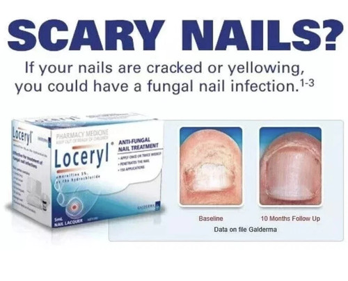 Nail fungal - latest),